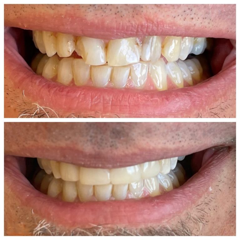 bio clear near you calgary
